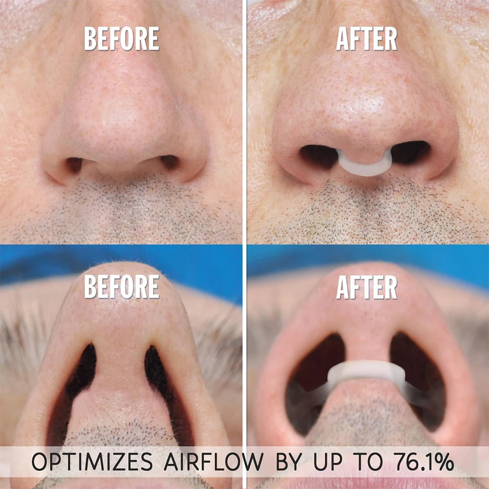 4Pcs Silicone Nose Clip Anti Snoring Nasal Dilator Stop Snore Aid Easy Breathe Improve Sleeping Rhinitis