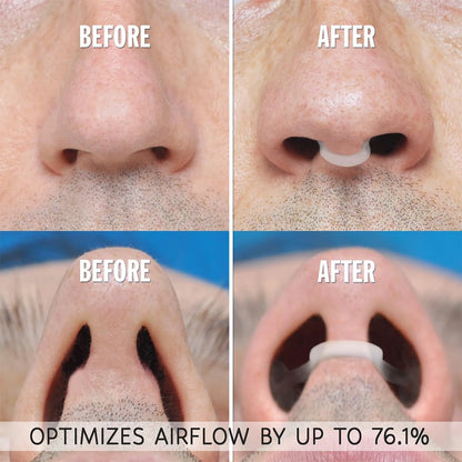 4Pcs Silicone Nose Clip Anti Snoring Nasal Dilator Stop Snore Aid Easy Breathe Improve Sleeping Rhinitis